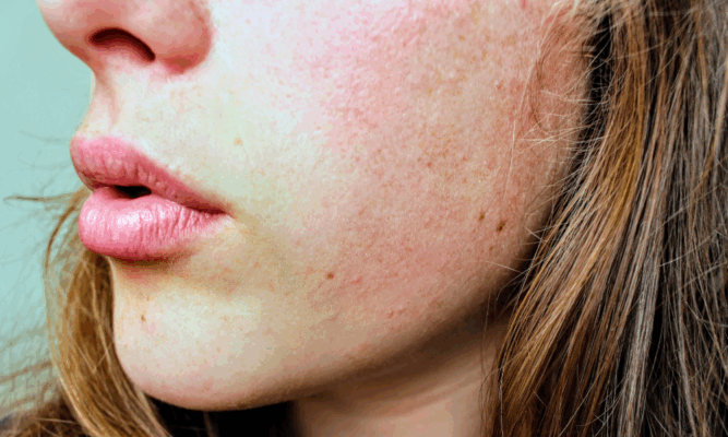Gros plan sur le visage d’une femme, montrant une peau naturelle et saine, pour illustrer le choix du savon selon les types de peau.