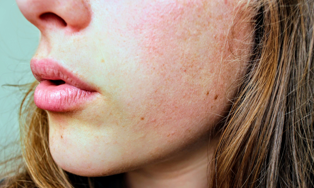 Gros plan sur le visage d’une femme, montrant une peau naturelle et saine, pour illustrer le choix du savon selon les types de peau.